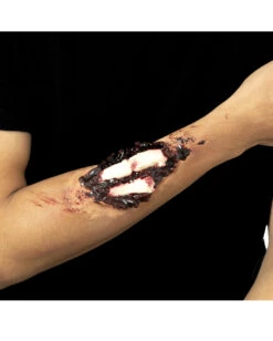 Knochenbruch Latexwunde