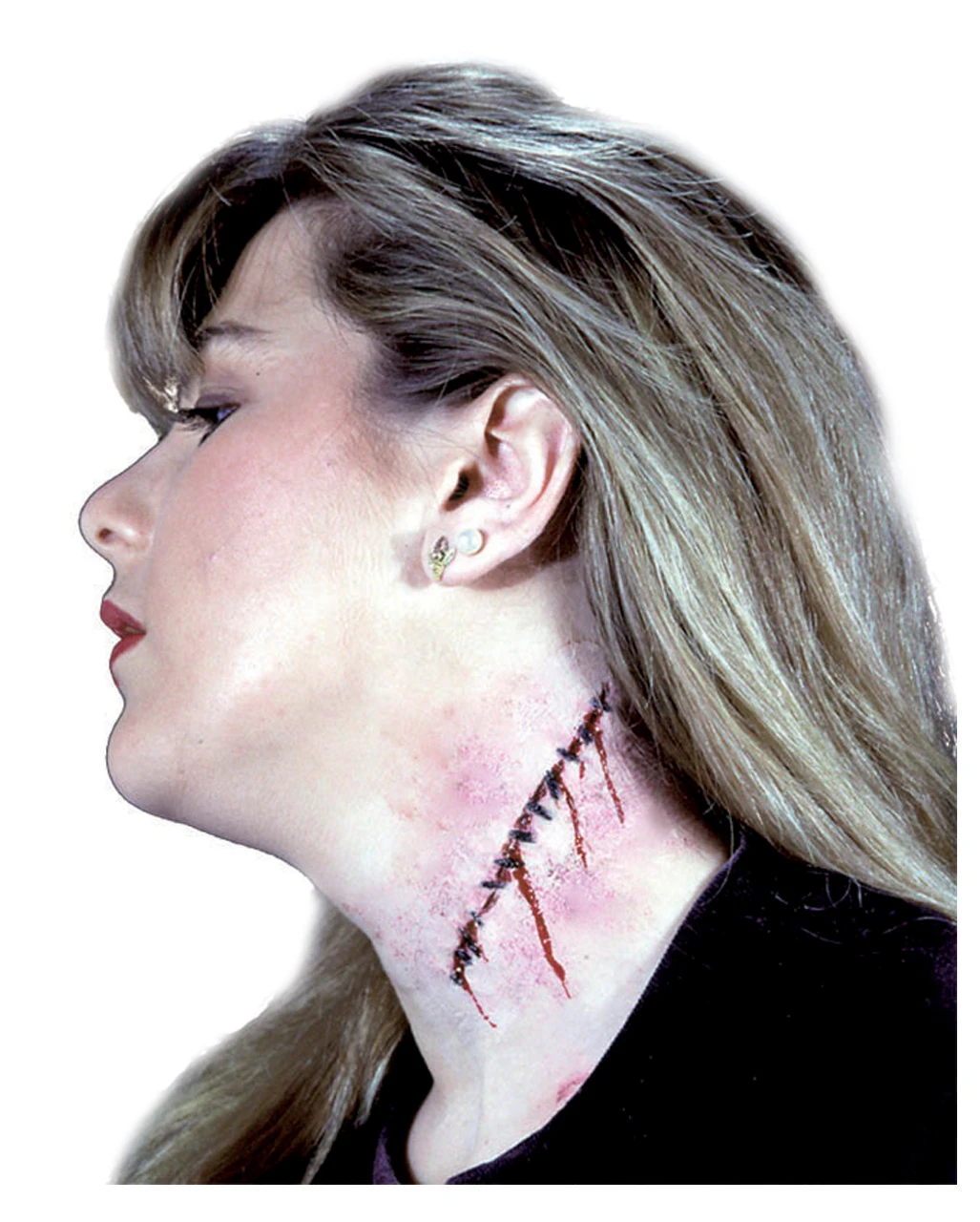 Genähte Latexwunde 3 Genähte Latexwunde